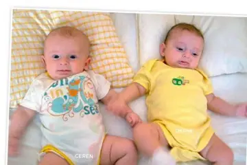 Hidrosefali Bebek Gelişimi Belirtileri