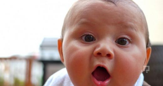 Hidrosefali Hastalığı Belirtileri ve Tedavisi